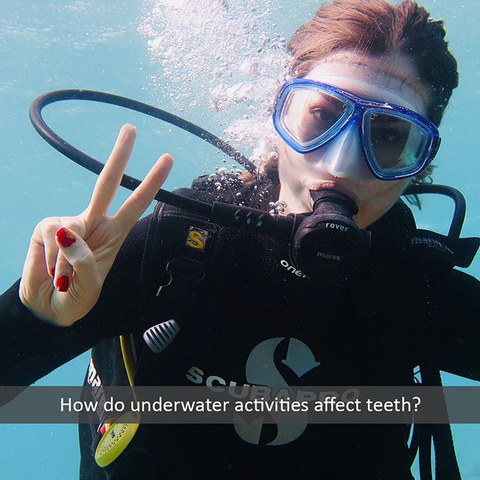 Heninger Dental: Dr Cam Heninger in Orem underwater teeth 2022 700