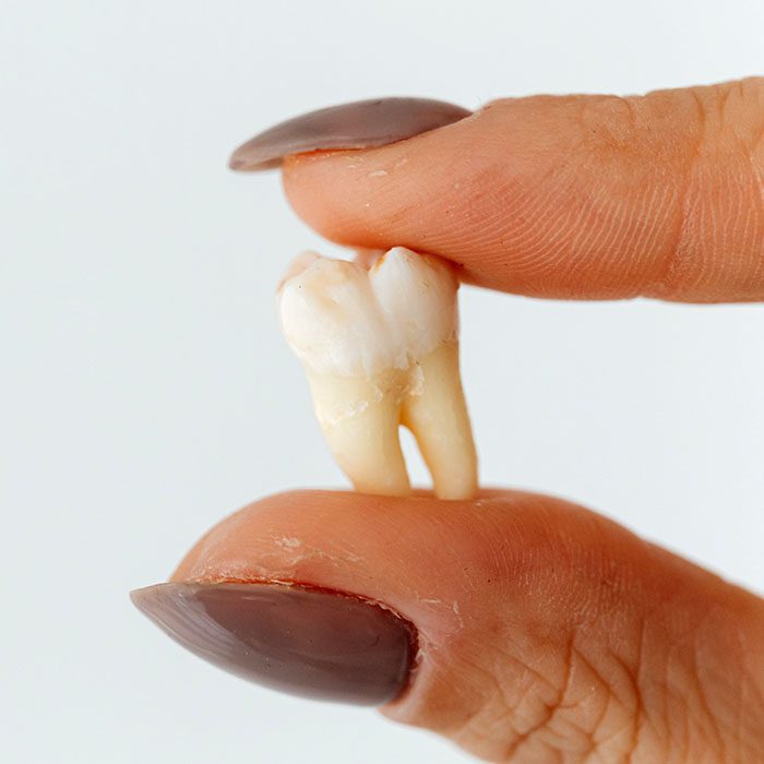 Heninger Dental: Dr Cam Heninger in Orem baby teeth traditions 2023 700